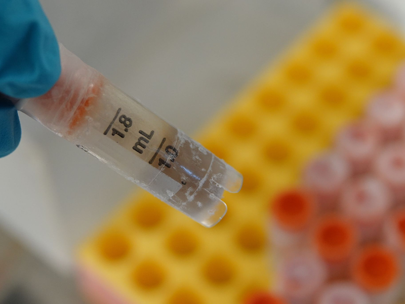 Eine eingefrorene Stuhlprobe in einem Gläschen. - Foto: Christiane Oelrich/dpa