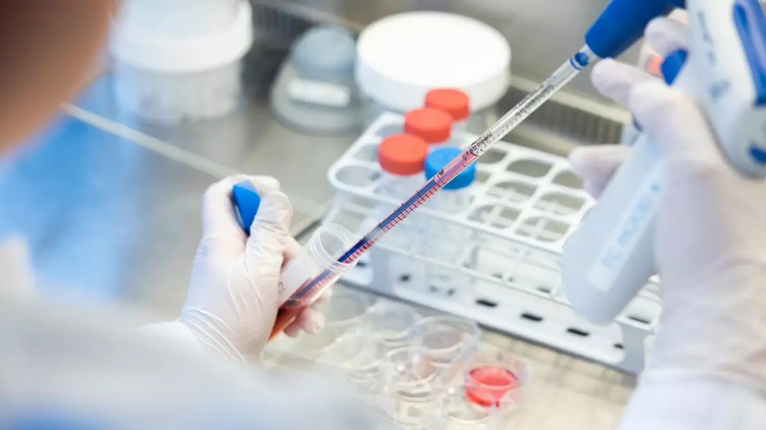 Wann schlägt eine Immuntherapie an? / Forscher nehmen die CAR-T-Zell-Therapie genau unter die Lupe - Bild: presseportal.de