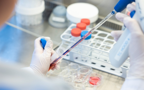 Wann schlägt eine Immuntherapie an? / Forscher nehmen die CAR-T-Zell-Therapie genau unter die Lupe - Foto: presseportal.de Wann schlägt eine Immuntherapie an? / Forscher nehmen die CAR-T-Zell-Therapie genau unter die Lupe - Foto: presseportal.de