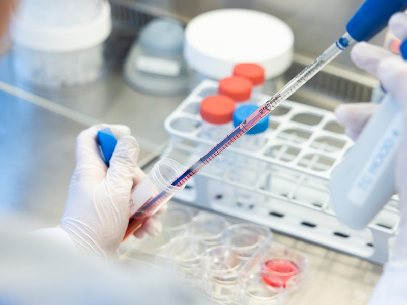 Wann schlägt eine Immuntherapie an? / Forscher nehmen die CAR-T-Zell-Therapie genau unter die Lupe - Foto: presseportal.de