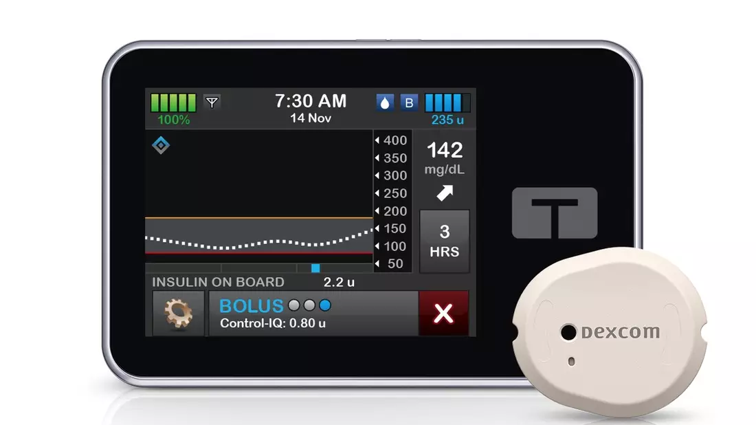 Ein starke Partnerschaft: Das Dexcom G7 rtCGM-System ist jetzt mit der Tandem t:slim X2 verknüpfbar - Bild: presseportal.de