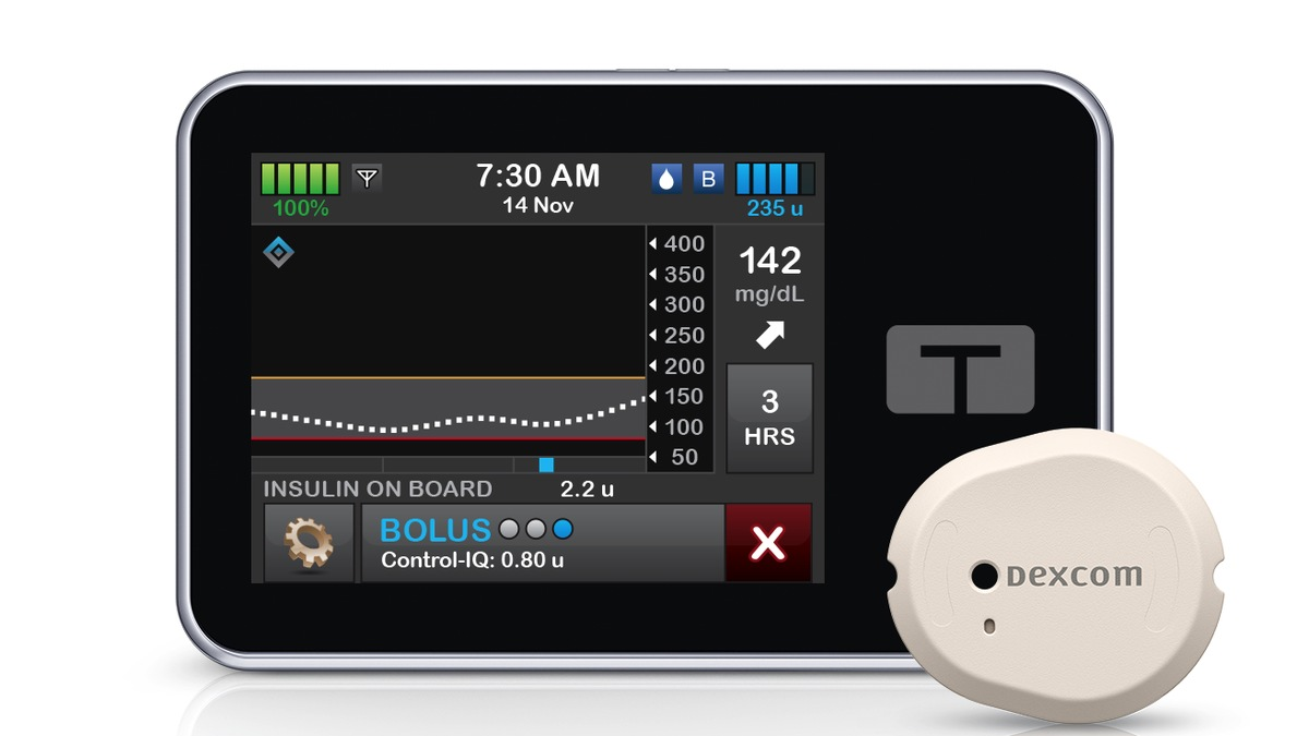 Ein starke Partnerschaft: Das Dexcom G7 rtCGM-System ist jetzt mit der Tandem t:slim X2 verknüpfbar - Foto: presseportal.de