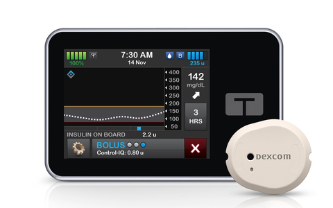 Ein starke Partnerschaft: Das Dexcom G7 rtCGM-System ist jetzt mit der Tandem t:slim X2 verknüpfbar - Foto: presseportal.de