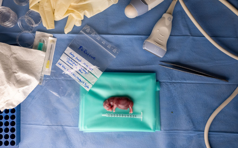 Ein durch künstliche Befruchtung erzeugter Embryo eines südlichen Breitmaulnashorns. - Foto: Jon A. Juarez/Conservation and Research Fund e.V./dpa Ein durch künstliche Befruchtung erzeugter Embryo eines südlichen Breitmaulnashorns. - Foto: Jon A. Juarez/Conservation and Research Fund e.V./dpa