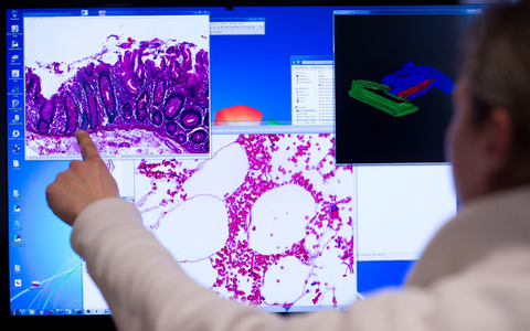 Darstellung einer eingescannten Probe eines Stück Gewebes aus dem Dickdarm, das bei einer Operation entnommenen wurde. - Foto: Bernd von Jutrczenka/dpa Darstellung einer eingescannten Probe eines Stück Gewebes aus dem Dickdarm, das bei einer Operation entnommenen wurde. - Foto: Bernd von Jutrczenka/dpa