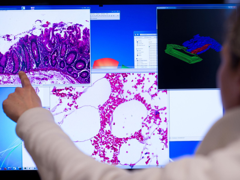 Darstellung einer eingescannten Probe eines Stück Gewebes aus dem Dickdarm, das bei einer Operation entnommenen wurde. - Foto: Bernd von Jutrczenka/dpa