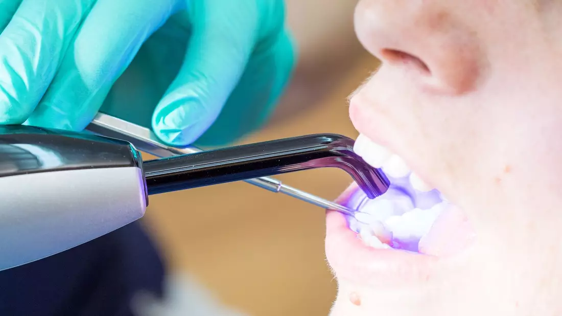 Laut KZBV-Vorstandschef Hendges gehen bei fachgerechtem Einsatz von Dentalamalgam keine Gesundheitsgefahren aus. - Bild: Christin Klose/dpa