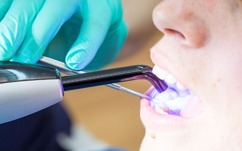 Laut KZBV-Vorstandschef Hendges gehen bei fachgerechtem Einsatz von Dentalamalgam keine Gesundheitsgefahren aus. - Foto: Christin Klose/dpa