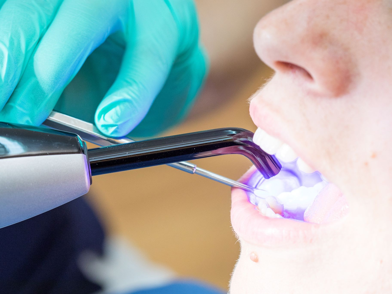 Laut KZBV-Vorstandschef Hendges gehen bei fachgerechtem Einsatz von Dentalamalgam keine Gesundheitsgefahren aus. - Foto: Christin Klose/dpa