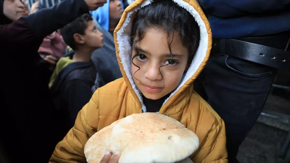 Im Zuge des Krieges ist die Zahl der unterernährten Kinder nach Angaben der WHO stark angestiegen. - Bild: Yasser Qudih/XinHua/dpa