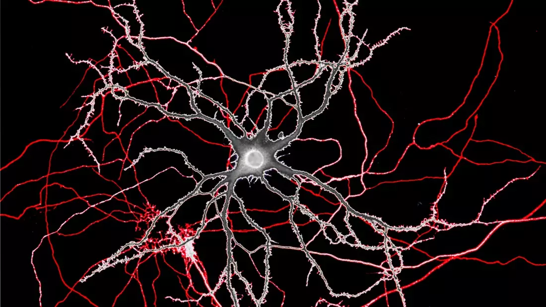 PhD „Mental Health and Neuroscience“ an KL Krems akkreditiert - Bild: presseportal.de