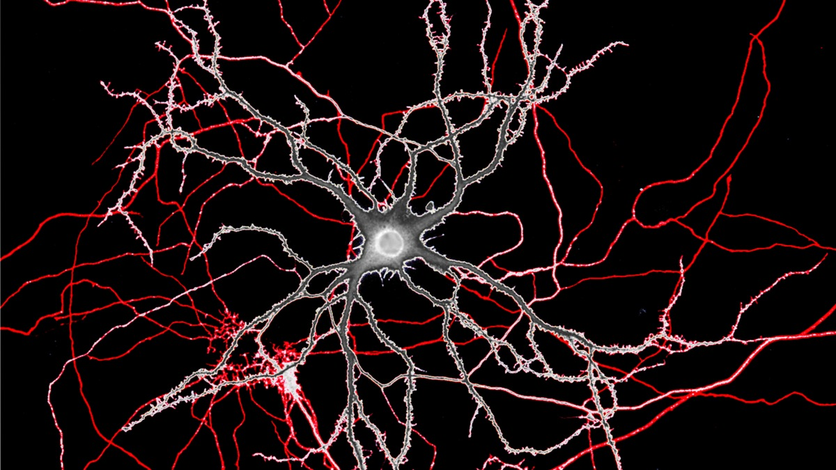 PhD „Mental Health and Neuroscience“ an KL Krems akkreditiert - Foto: presseportal.de