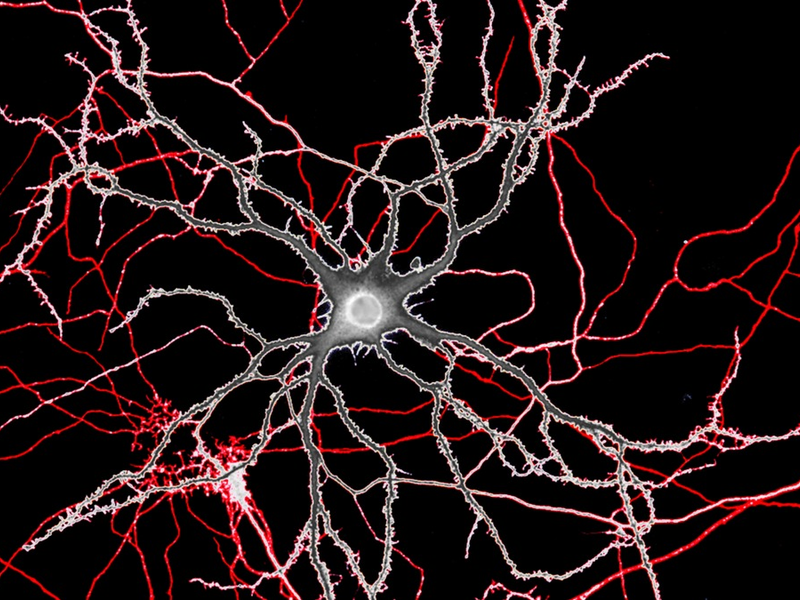 PhD „Mental Health and Neuroscience“ an KL Krems akkreditiert - Foto: presseportal.de