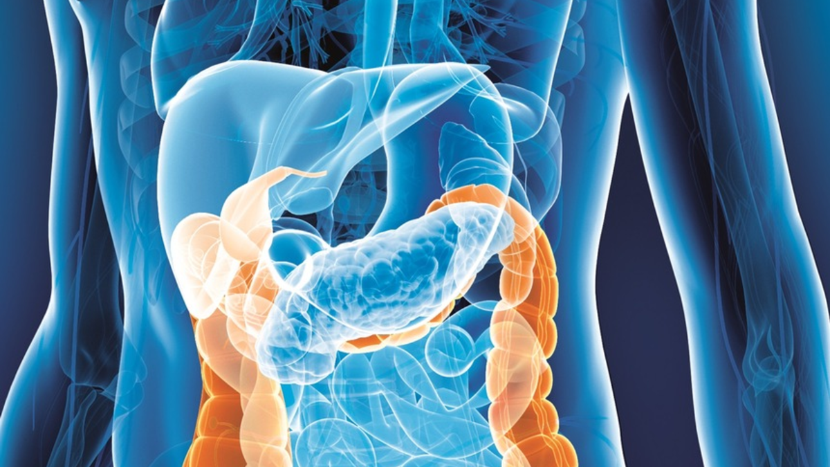 Darmkrebsmonat März: Forschung hilft / Mit Forschungsprojekten die Versorgung von Darmkrebspatienten verbessern - Foto: presseportal.de