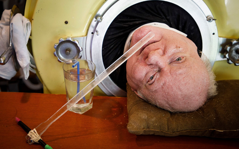 Paul Alexander war über 70 Jahre auf eine eiserne Lunge angewiesen, nun ist er gestorben. - Foto: Smiley N. Pool/The Dallas Morning News/AP/dpa