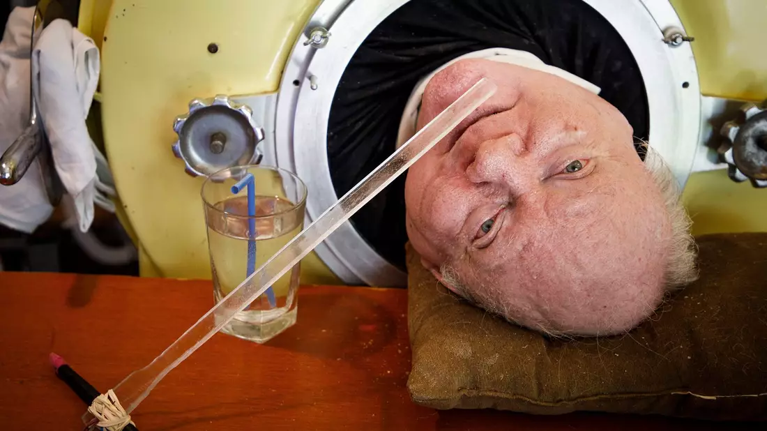 Paul Alexander ist im Alter von 78 Jahren gestorben. - Bild: Smiley N. Pool/The Dallas Morning News/AP/dpa