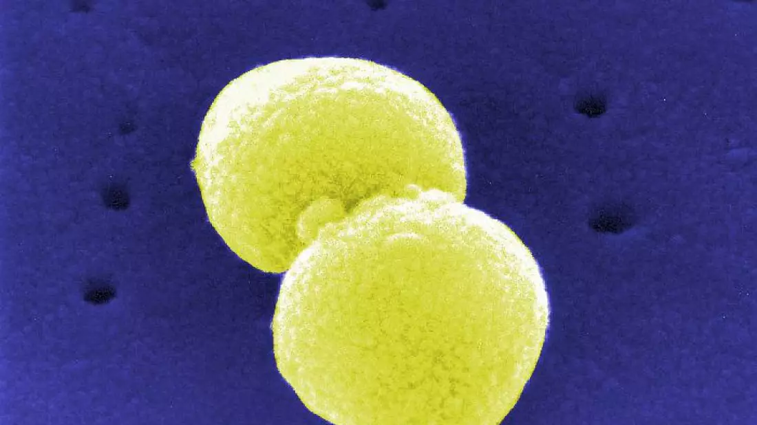 Streptococcus pneumoniae (Archiv) - Bild: über dts Nachrichtenagentur