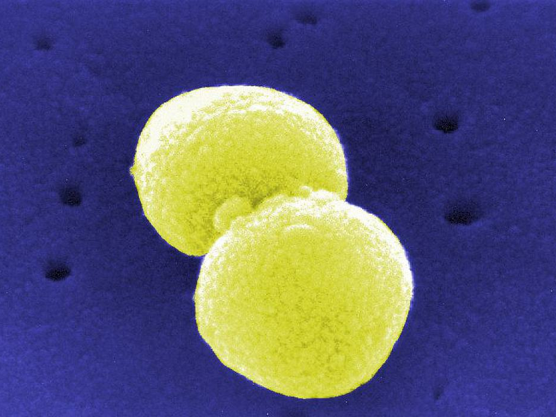 Streptococcus pneumoniae (Archiv) - Foto: über dts Nachrichtenagentur