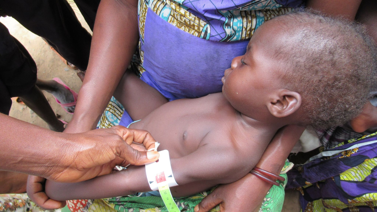 Die meisten Hungernden lebten im vergangenen Jahr in der Demokratischen Republik Kongo (25,8 Millionen), gefolgt von Nigeria, dem Sudan und Afghanistan. - Foto: Kate Bartlett/dpa