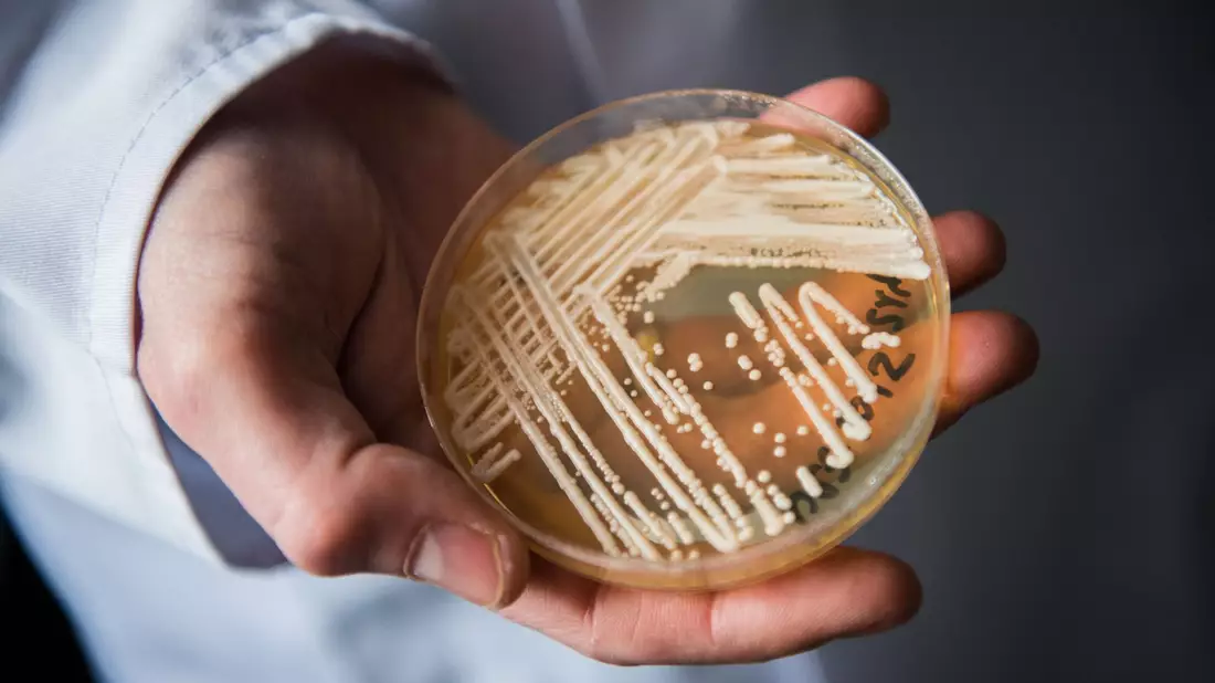 Eine Petrischale mit dem Hefepilz Candida auris. In Deutschland werden immer mehr Fälle des krankmachenden Pilzes bekannt. - Bild: Nicolas Armer/dpa