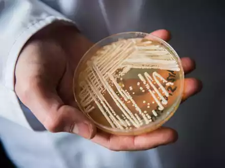 Eine Petrischale mit dem Hefepilz Candida auris. In Deutschland werden immer mehr Fälle des krankmachenden Pilzes bekannt. - Foto: Nicolas Armer/dpa