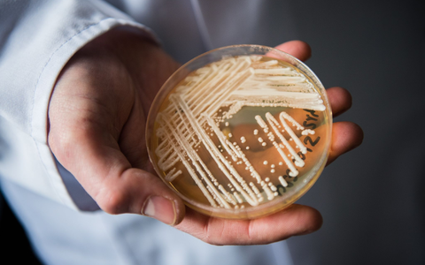Eine Petrischale mit dem Hefepilz Candida auris. In Deutschland werden immer mehr Fälle des krankmachenden Pilzes bekannt. - Foto: Nicolas Armer/dpa