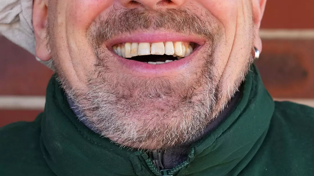 Könnte Lachen ein Therapieansatz werden? - Bild: Soeren Stache/dpa-Zentralbild/dpa