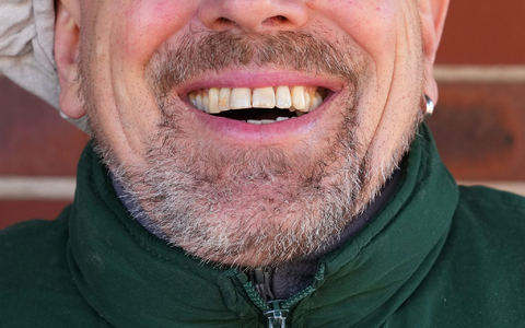 Könnte Lachen ein Therapieansatz werden? - Foto: Soeren Stache/dpa-Zentralbild/dpa