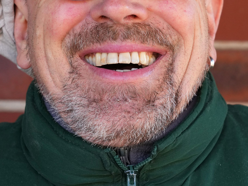 Könnte Lachen ein Therapieansatz werden? - Foto: Soeren Stache/dpa-Zentralbild/dpa