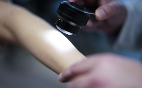 Ein Hautarzt untersucht bei einer Krebsvorsorgeuntersuchung eine Patientin mit einem Auflichtmikroskop. - Foto: Eva Manhart/apa/dpa Ein Hautarzt untersucht bei einer Krebsvorsorgeuntersuchung eine Patientin mit einem Auflichtmikroskop. - Foto: Eva Manhart/apa/dpa