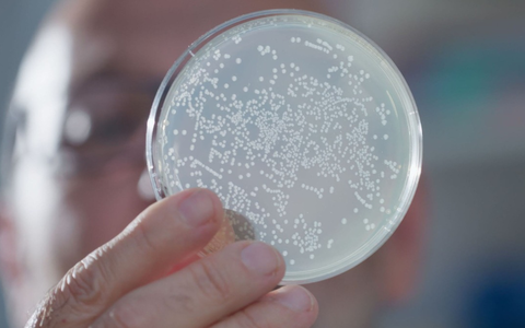 WissenHoch2 in 3sat über KI in der Medizin und winzige Antikörper - Foto: presseportal.de