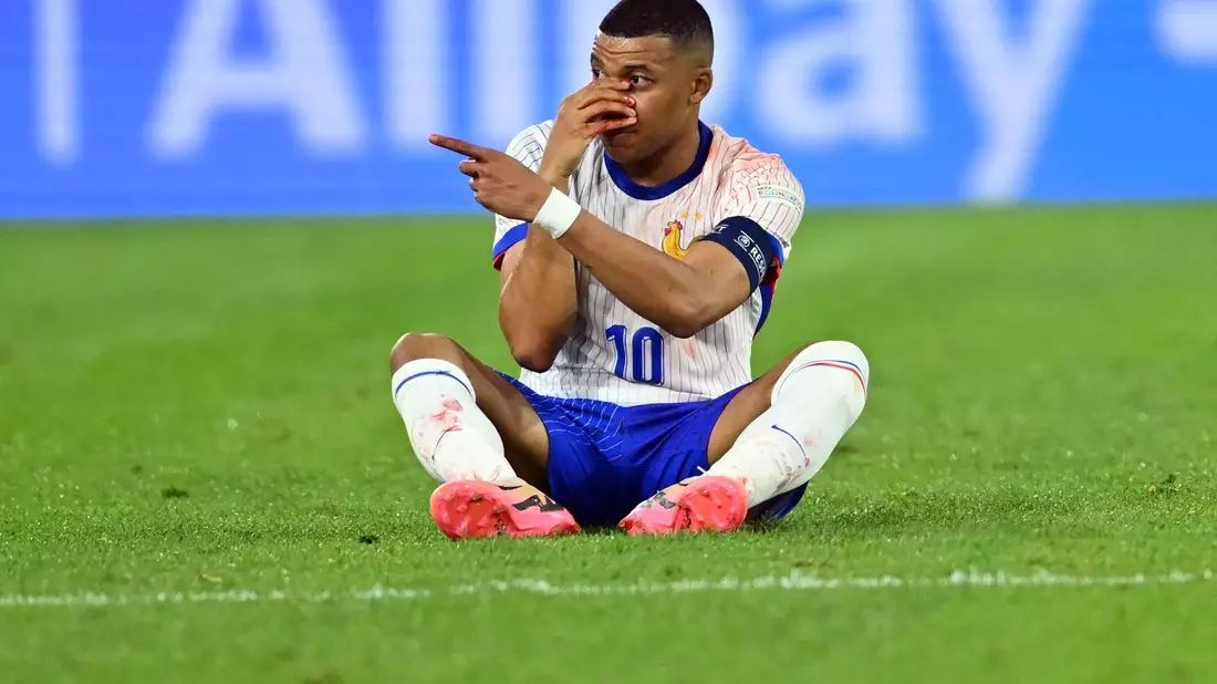 Kylian Mbappé musste nach einem Zusammenprall mit einer Nasen-Verletzung ausgewechselt werden. - Bild: Marius Becker/dpa