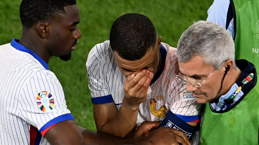 Mbappé (M) musste mit stark blutender Nase ausgewechselt werden. - Bild: Fabian Strauch/dpa