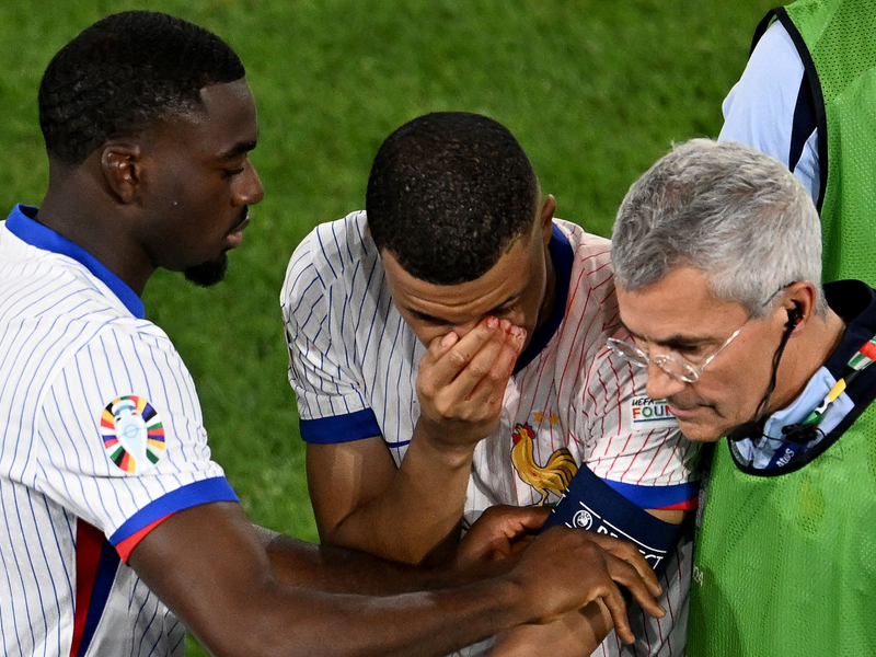 Mbappé (M) musste mit stark blutender Nase ausgewechselt werden. - Foto: Fabian Strauch/dpa