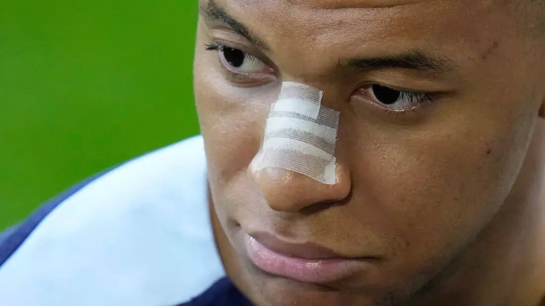 Kann Frankreichs Superstar Kylian Mbappé am Freitag spielen? - Bild: Hassan Ammar/AP