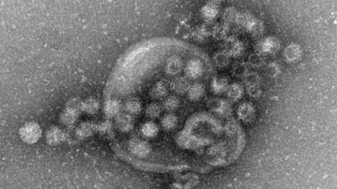 Das hochansteckende Norovirus verursacht einen plötzlich auftretenden, heftigen Brechdurchfall. (Archivbild) - Bild: Gudrun Holland/RKI/Robert-Koch-Institut/dpa