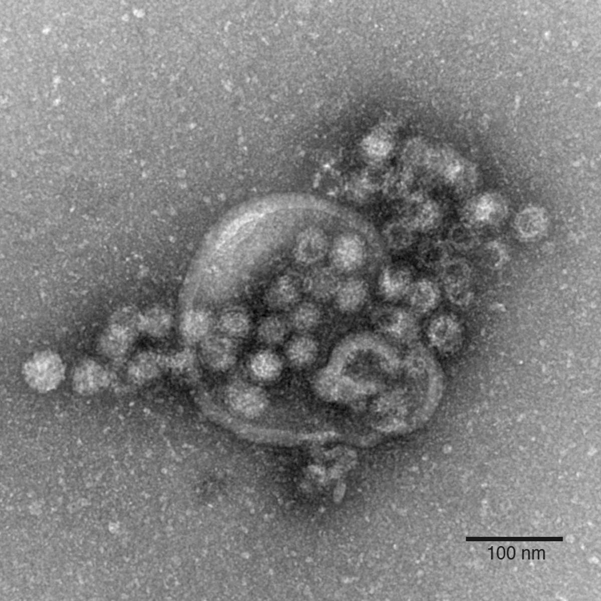 Das hochansteckende Norovirus verursacht einen plötzlich auftretenden, heftigen Brechdurchfall. - Foto: Gudrun Holland/RKI/Robert-Koch-Institut/dpa