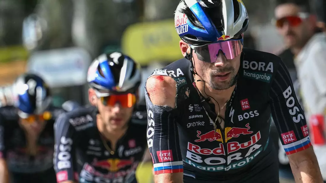 Red Bull-BORA-hansgrohe-Kapitän Primoz Roglic stürzte kurz vor dem Ziel schwer. - Bild: Marco Bertorello/AFP/dpa