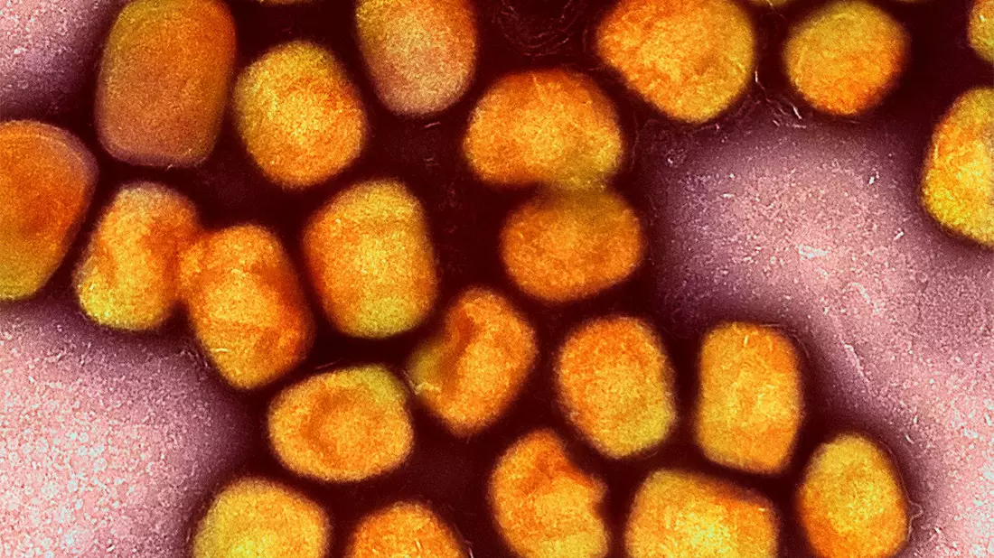 Eine neue Variante des Mpox-Virus könnte gefährlicher sein als bisherige Varianten. - Bild: Niaid/Niaid/Planet Pix via ZUMA Press Wire/dpa