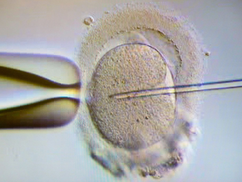 Ein Spermium wird eine Eizelle injiziert. Wird die Eizellenspende bald legal? (Archivbild) - Foto: Klaus-Dietmar Gabbert/dpa-Zentralbild/dpa