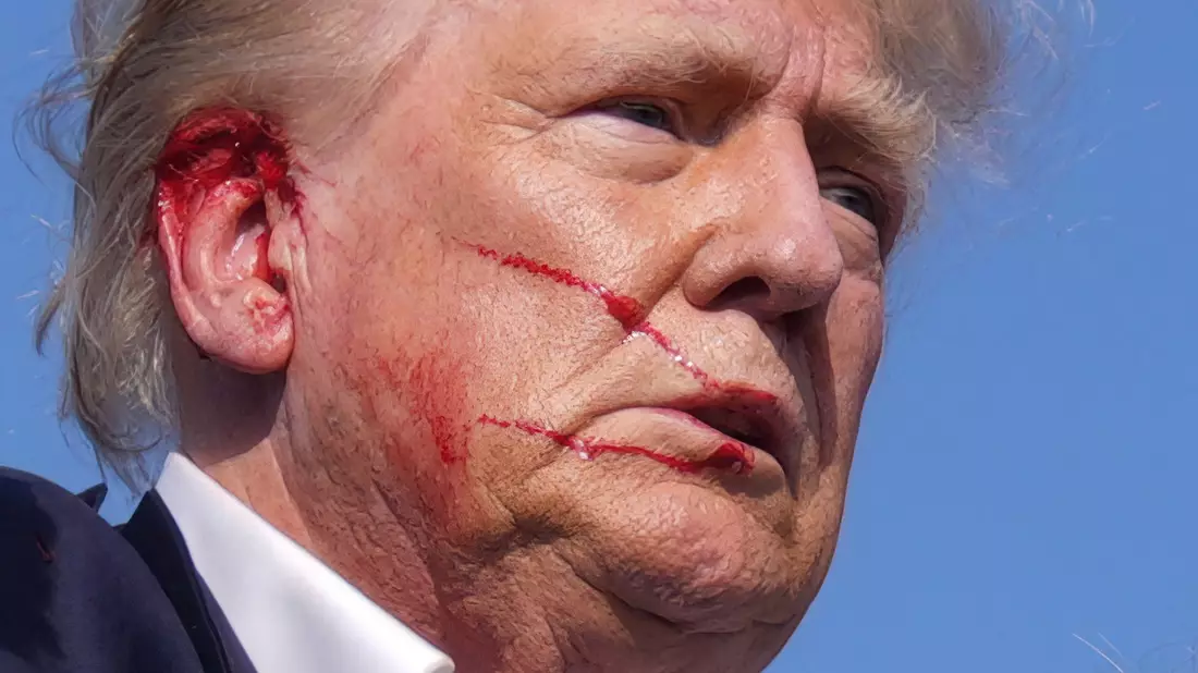 Die Schusswunde des republikanischen Präsidentschaftskandidaten Donald Trump verheilt nach Angaben seines Arztes gut. (Archivbild) - Bild: Evan Vucci/AP/dpa