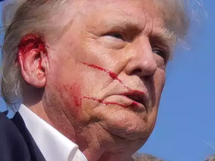 Die Schusswunde des republikanischen Präsidentschaftskandidaten Donald Trump verheilt nach Angaben seines Arztes gut. (Archivbild) - Foto: Evan Vucci/AP/dpa