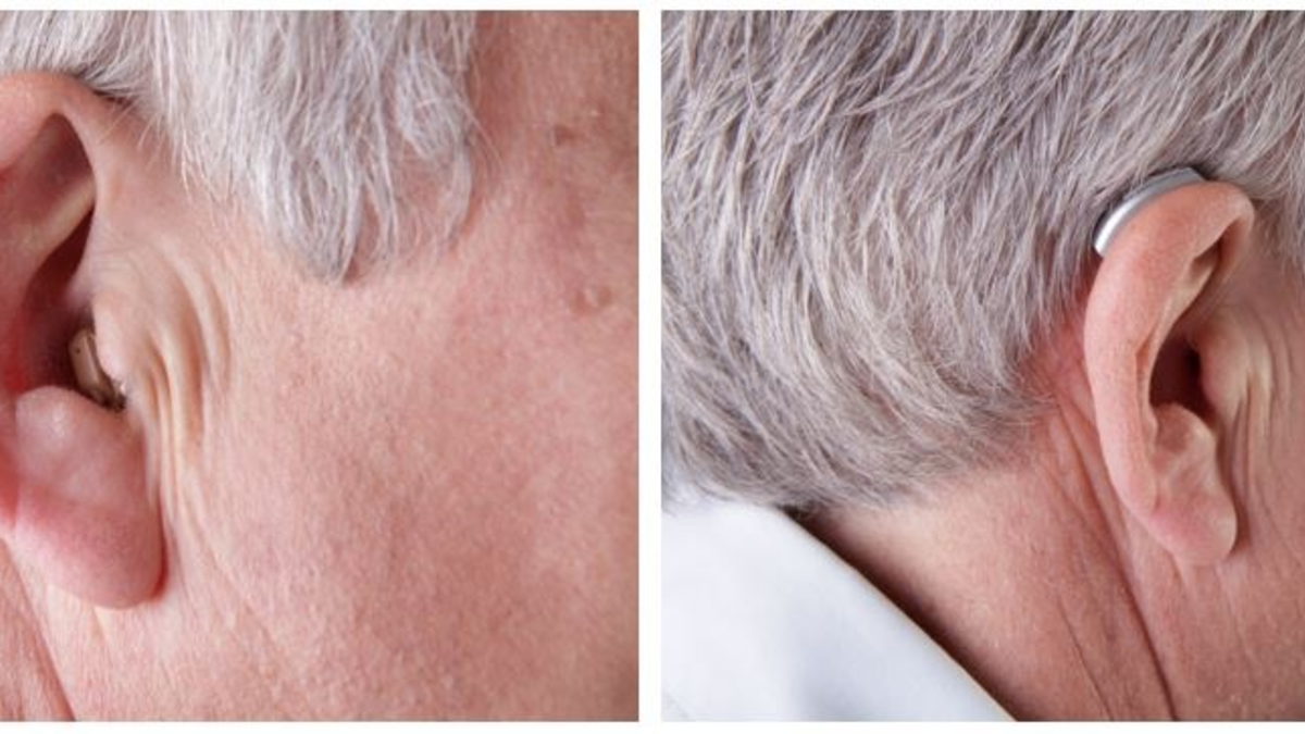 Im Ohr oder hinter dem Ohr: Welches Hörsystem passt zu wem? - Foto: presseportal.de