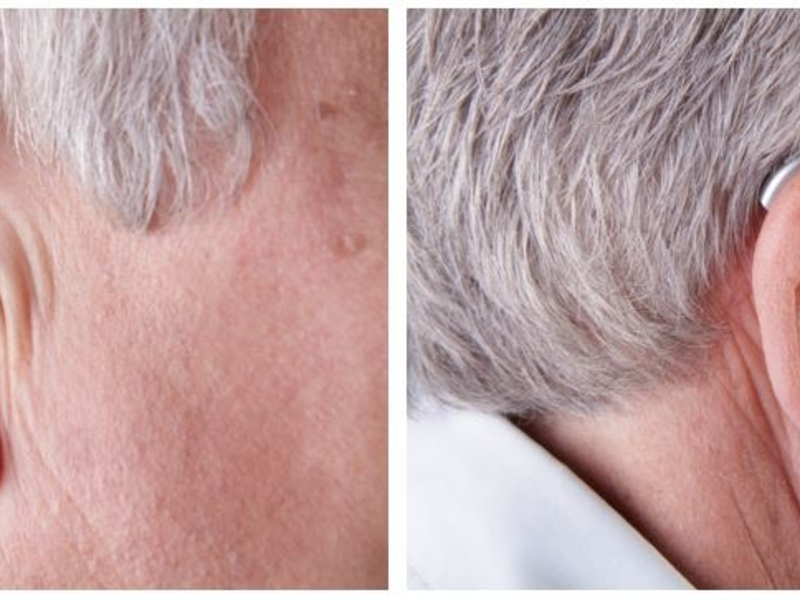 Im Ohr oder hinter dem Ohr: Welches Hörsystem passt zu wem? - Foto: presseportal.de