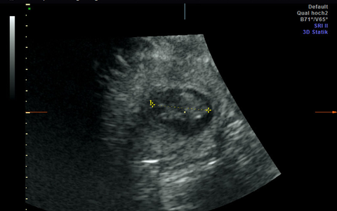 Die Babies sind etwa 2,5 Zentimeter groß. (Handout) - Foto: Zoo Berlin/dpa