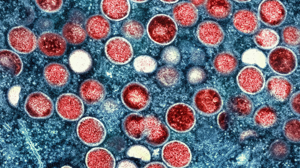 Diese Mikroskopaufnahme zeigt Mpox-Partikel in einer Zelle.  - Foto: -/National Institute of Allergy and Infectious Diseases/dpa