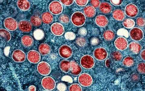 Diese Mikroskopaufnahme zeigt Mpox-Partikel in einer Zelle.  - Foto: -/National Institute of Allergy and Infectious Diseases/dpa