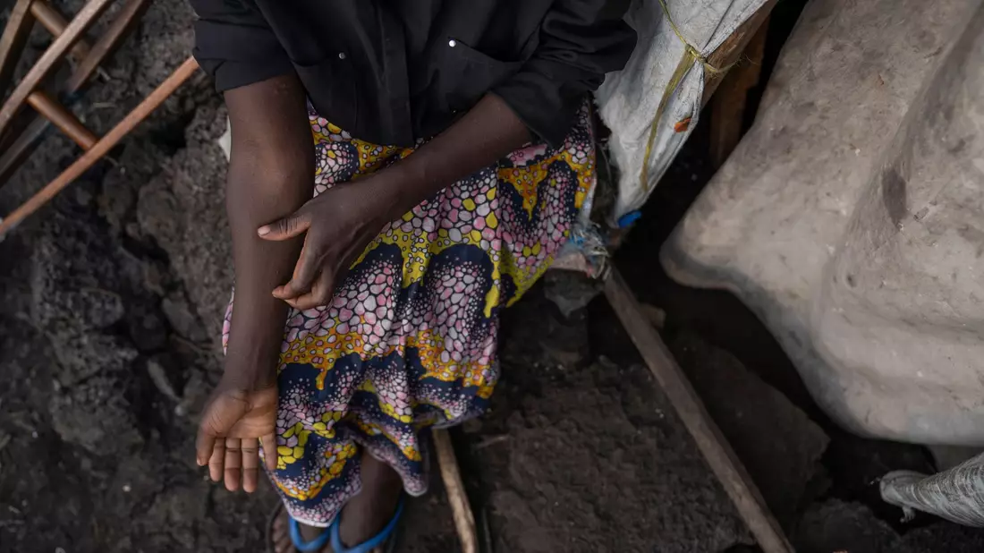 Um eine weitere Mpox-Ausbreitung zu verhindern, brauchen die Länder dringend Impfstoff. (Archivbild) - Bild: Moses Sawasawa/AP/dpa