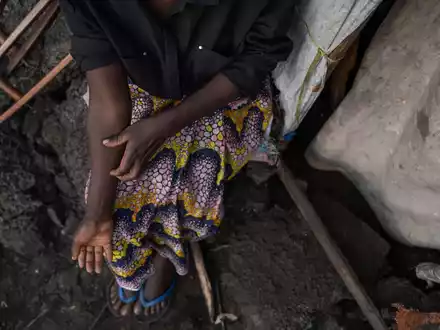 Um eine weitere Mpox-Ausbreitung zu verhindern, brauchen die Länder dringend Impfstoff. (Archivbild) - Foto: Moses Sawasawa/AP/dpa