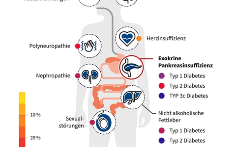 Unterschätzte Gefahr bei Diabetes mellitus: Unterzuckerungen durch Verdauungsenzymmangel - Foto: presseportal.de